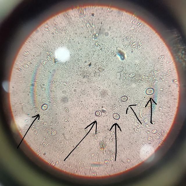A microscopic view of coccidiosis
