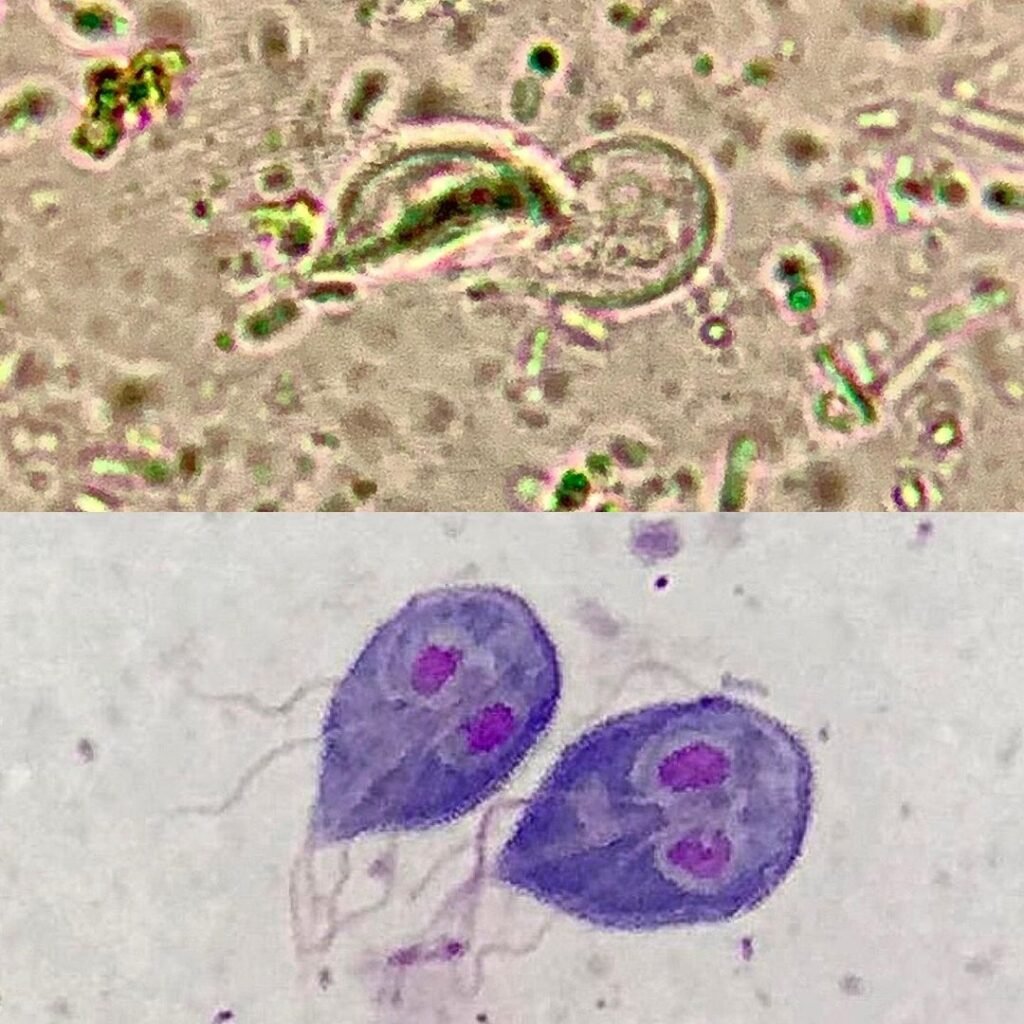 Microscopic view of Giardia