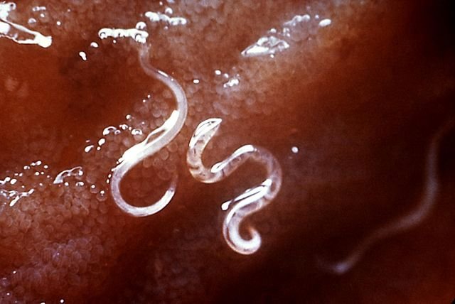 A microscopic view of hookworms